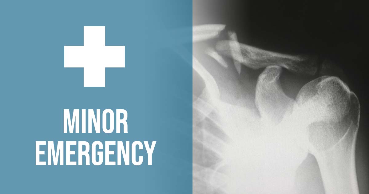 Minor Emergency Horn Lake Family Practice
